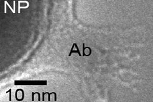 Contrast-Enhanced CT of Targeted Nanoparticles